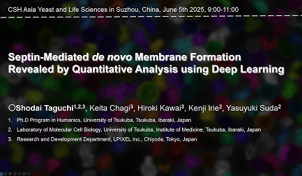 田口 将大さん（ヒューマニクス5年生）がCold Spring Harbor LaboratoryのYeast and Life Scienceにて口頭発表を行いました。